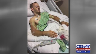 street bike tommy crash injuries